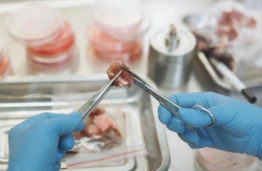 KTU mokslininkai kuria ateities mėsą: bus galima tiksliai kontroliuoti jos maistinę vertę